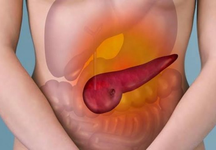 Upala pankreasa može biti opasna ako se ne liječi na vrijeme: OVO SU PRVI SIMPTOMI DA ĆE VAM GUŠTERAČA STRADATI - featured image Upala pankreasa može biti opasna ako se ne liječi na vrijeme: OVO SU PRVI SIMPTOMI DA ĆE VAM GUŠTERAČA STRADATI - featured image