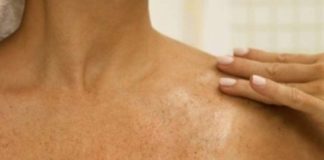 SMEĐE MRLJE SU ČESTE PO TIJELU, ALI POSTOJI NAČIN KAKO DA IH UKLONITE: Dermatolog otkrio tajnu, smjesa ova dva sastojka čini čuda! SMEĐE MRLJE SU ČESTE PO TIJELU, ALI POSTOJI NAČIN KAKO DA IH UKLONITE: Dermatolog otkrio tajnu, smjesa ova dva sastojka čini čuda! - featured image