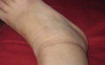 KAD SKINETE ČARAPE OSTANU VAM TRAGOVI NA NOGAMA: Evo šta se dešava sa vašim zdravljem KAD SKINETE ČARAPE OSTANU VAM TRAGOVI NA NOGAMA: Evo šta se dešava sa vašim zdravljem - featured image