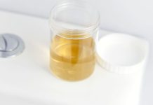 BOJA URINA OTKRIVA NAJTEŽE BOLESTI! Ovo je razlog zbog kog vam je mokraća mutna BOJA URINA OTKRIVA NAJTEŽE BOLESTI! Ovo je razlog zbog kog vam je mokraća mutna - featured image