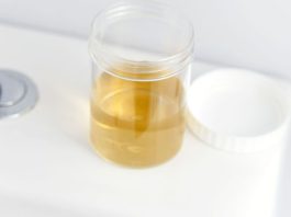 BOJA URINA OTKRIVA NAJTEŽE BOLESTI! Ovo je razlog zbog kog vam je mokraća mutna BOJA URINA OTKRIVA NAJTEŽE BOLESTI! Ovo je razlog zbog kog vam je mokraća mutna - featured image