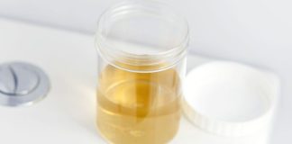 BOJA URINA OTKRIVA NAJTEŽE BOLESTI! Ovo je razlog zbog kog vam je mokraća mutna BOJA URINA OTKRIVA NAJTEŽE BOLESTI! Ovo je razlog zbog kog vam je mokraća mutna - featured image