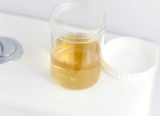 BOJA URINA OTKRIVA NAJTEŽE BOLESTI! Ovo je razlog zbog kog vam je mokraća mutna BOJA URINA OTKRIVA NAJTEŽE BOLESTI! Ovo je razlog zbog kog vam je mokraća mutna - featured image