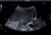 NADBUBREŽNA ŽLIJEZDA MOŽE DA RAZORI CIJELI ORGANIZAM: Simptomi koje nikako ne smijete da ignorišete! NADBUBREŽNA ŽLIJEZDA MOŽE DA RAZORI CIJELI ORGANIZAM: Simptomi koje nikako ne smijete da ignorišete! - featured image