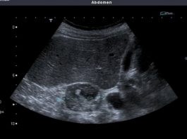 NADBUBREŽNA ŽLIJEZDA MOŽE DA RAZORI CIJELI ORGANIZAM: Simptomi koje nikako ne smijete da ignorišete! NADBUBREŽNA ŽLIJEZDA MOŽE DA RAZORI CIJELI ORGANIZAM: Simptomi koje nikako ne smijete da ignorišete! - featured image