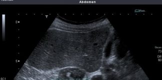 NADBUBREŽNA ŽLIJEZDA MOŽE DA RAZORI CIJELI ORGANIZAM: Simptomi koje nikako ne smijete da ignorišete! NADBUBREŽNA ŽLIJEZDA MOŽE DA RAZORI CIJELI ORGANIZAM: Simptomi koje nikako ne smijete da ignorišete! - featured image