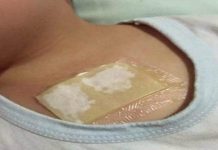 Ovaj kućni lijek rastvara sluz u plućima i oslobađa kašlja. Preko noći uklanja i najteži kašalj, te čisti pluća od nakupljene sluzi! Ovaj kućni lijek rastvara sluz u plućima i oslobađa kašlja. Preko noći uklanja i najteži kašalj, te čisti pluća od nakupljene sluzi! - featured image