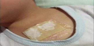 Ovaj kućni lijek rastvara sluz u plućima i oslobađa kašlja. Preko noći uklanja i najteži kašalj, te čisti pluća od nakupljene sluzi! Ovaj kućni lijek rastvara sluz u plućima i oslobađa kašlja. Preko noći uklanja i najteži kašalj, te čisti pluća od nakupljene sluzi! - featured image