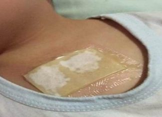 Ovaj kućni lijek rastvara sluz u plućima i oslobađa kašlja. Preko noći uklanja i najteži kašalj, te čisti pluća od nakupljene sluzi! Ovaj kućni lijek rastvara sluz u plućima i oslobađa kašlja. Preko noći uklanja i najteži kašalj, te čisti pluća od nakupljene sluzi! - featured image