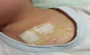 Ovaj kućni lijek rastvara sluz u plućima i oslobađa kašlja. Preko noći uklanja i najteži kašalj, te čisti pluća od nakupljene sluzi! Ovaj kućni lijek rastvara sluz u plućima i oslobađa kašlja. Preko noći uklanja i najteži kašalj, te čisti pluća od nakupljene sluzi! - featured image