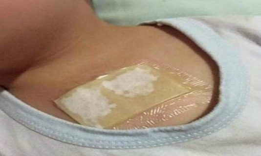 Ovaj kućni lijek rastvara sluz u plućima i oslobađa kašlja. Preko noći uklanja i najteži kašalj, te čisti pluća od nakupljene sluzi! Ovaj kućni lijek rastvara sluz u plućima i oslobađa kašlja. Preko noći uklanja i najteži kašalj, te čisti pluća od nakupljene sluzi! - featured image