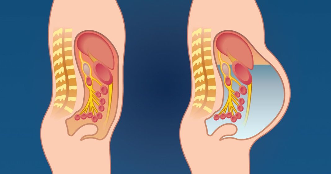 Otok stomaka izazivaju mnogi uzroci, a neki zahtevaju hitan lekarski pregled - featured image Otok stomaka izazivaju mnogi uzroci, a neki zahtevaju hitan lekarski pregled - featured image