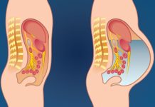 Otok stomaka izazivaju mnogi uzroci, a neki zahtevaju hitan lekarski pregled Otok stomaka izazivaju mnogi uzroci, a neki zahtevaju hitan lekarski pregled - featured image