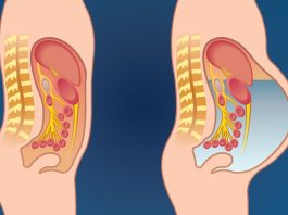 Otok stomaka izazivaju mnogi uzroci, a neki zahtevaju hitan lekarski pregled Otok stomaka izazivaju mnogi uzroci, a neki zahtevaju hitan lekarski pregled - featured image