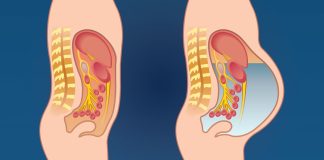 Otok stomaka izazivaju mnogi uzroci, a neki zahtevaju hitan lekarski pregled Otok stomaka izazivaju mnogi uzroci, a neki zahtevaju hitan lekarski pregled - featured image