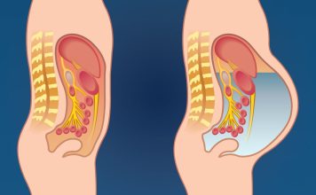 Otok stomaka izazivaju mnogi uzroci, a neki zahtevaju hitan lekarski pregled Otok stomaka izazivaju mnogi uzroci, a neki zahtevaju hitan lekarski pregled - featured image