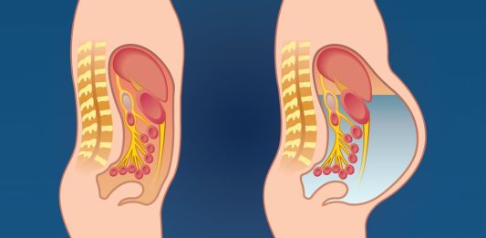 Otok stomaka izazivaju mnogi uzroci, a neki zahtevaju hitan lekarski pregled Otok stomaka izazivaju mnogi uzroci, a neki zahtevaju hitan lekarski pregled - featured image
