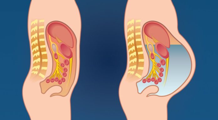 Otok stomaka izazivaju mnogi uzroci, a neki zahtevaju hitan lekarski pregled Otok stomaka izazivaju mnogi uzroci, a neki zahtevaju hitan lekarski pregled - featured image