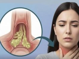 Kako ublažiti sluz u grlu: bezbedni i prirodni saveti za svakodnevno olakšanje Kako ublažiti sluz u grlu: bezbedni i prirodni saveti za svakodnevno olakšanje - featured image