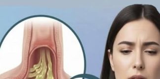 Kako ublažiti sluz u grlu: bezbedni i prirodni saveti za svakodnevno olakšanje Kako ublažiti sluz u grlu: bezbedni i prirodni saveti za svakodnevno olakšanje - featured image