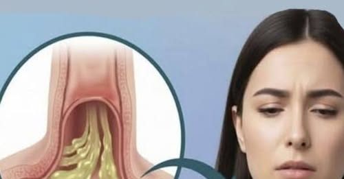 Kako ublažiti sluz u grlu: bezbedni i prirodni saveti za svakodnevno olakšanje Kako ublažiti sluz u grlu: bezbedni i prirodni saveti za svakodnevno olakšanje - featured image