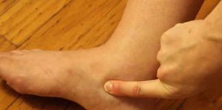 OTEKLE SU VAM NOGE? 3 PUTA DANAS POPIJTE OVAJ NAPITAK I problem riješen: Prirodni lijek koji pomaže, ubrzava metabolizam, IZBACUJE VODU! OTEKLE SU VAM NOGE? 3 PUTA DANAS POPIJTE OVAJ NAPITAK I problem riješen: Prirodni lijek koji pomaže, ubrzava metabolizam, IZBACUJE VODU! - featured image