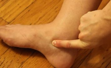OTEKLE SU VAM NOGE? 3 PUTA DANAS POPIJTE OVAJ NAPITAK I problem riješen: Prirodni lijek koji pomaže, ubrzava metabolizam, IZBACUJE VODU! OTEKLE SU VAM NOGE? 3 PUTA DANAS POPIJTE OVAJ NAPITAK I problem riješen: Prirodni lijek koji pomaže, ubrzava metabolizam, IZBACUJE VODU! - featured image
