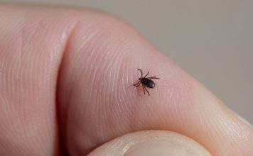 Krpelji ne podnose miris ove 2 biljke, posadite ih u dvorištu i nikada ih nećete vidjeti Krpelji ne podnose miris ove 2 biljke, posadite ih u dvorištu i nikada ih nećete vidjeti - featured image