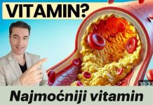 Najmoćniji vitamin za čišćenje arterija nakon 50. godine! Najmoćniji vitamin za čišćenje arterija nakon 50. godine! - featured image