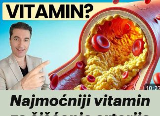 Najmoćniji vitamin za čišćenje arterija nakon 50. godine! Najmoćniji vitamin za čišćenje arterija nakon 50. godine! - featured image
