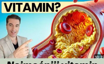 Najmoćniji vitamin za čišćenje arterija nakon 50. godine! Najmoćniji vitamin za čišćenje arterija nakon 50. godine! - featured image