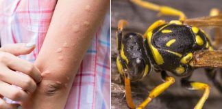 Simptomi ujeda stršljena koji su bili kobni za 38-godišnju ženu iz Vrnjačke Banje: Evo šta prvo morate da uradite da biste sprečili alergijsku reakciju Simptomi ujeda stršljena koji su bili kobni za 38-godišnju ženu iz Vrnjačke Banje: Evo šta prvo morate da uradite da biste sprečili alergijsku reakciju - featured image