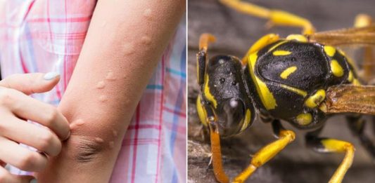 Simptomi ujeda stršljena koji su bili kobni za 38-godišnju ženu iz Vrnjačke Banje: Evo šta prvo morate da uradite da biste sprečili alergijsku reakciju Simptomi ujeda stršljena koji su bili kobni za 38-godišnju ženu iz Vrnjačke Banje: Evo šta prvo morate da uradite da biste sprečili alergijsku reakciju - featured image