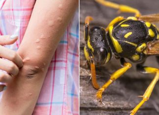 Simptomi ujeda stršljena koji su bili kobni za 38-godišnju ženu iz Vrnjačke Banje: Evo šta prvo morate da uradite da biste sprečili alergijsku reakciju Simptomi ujeda stršljena koji su bili kobni za 38-godišnju ženu iz Vrnjačke Banje: Evo šta prvo morate da uradite da biste sprečili alergijsku reakciju - featured image