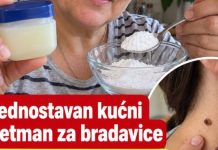 Jednostavan kućni tretman za bradavice. Mnogi ga koriste kao pomoć Jednostavan kućni tretman za bradavice. Mnogi ga koriste kao pomoć - featured image