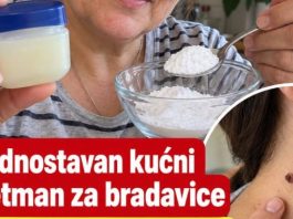 Jednostavan kućni tretman za bradavice. Mnogi ga koriste kao pomoć Jednostavan kućni tretman za bradavice. Mnogi ga koriste kao pomoć - featured image