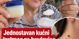 Jednostavan kućni tretman za bradavice. Mnogi ga koriste kao pomoć Jednostavan kućni tretman za bradavice. Mnogi ga koriste kao pomoć - featured image